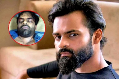 Sai Dharam Tej Injured In A Bike Accident Sai Dharam Tej Injured In A Bike Accident