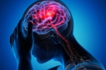 Canada Brain Disease treatment, Canada Brain Disease, canada is hit by a mysterious brain disease, Canada brain disease